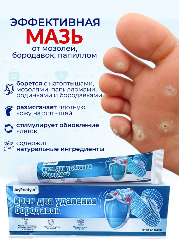Сержет.