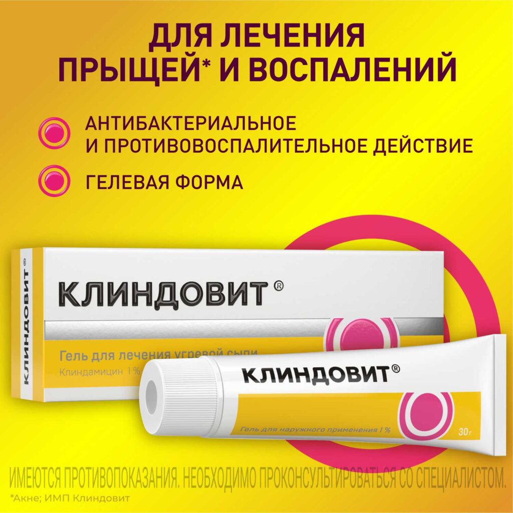 Куппит
