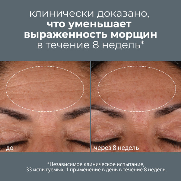 Ukreplaishiй antyvoзrastnoй nnevnoй -krem dynamic recovery spf50