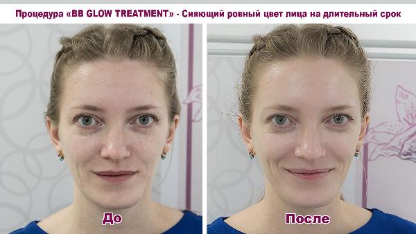 Vnimanie novynka! 