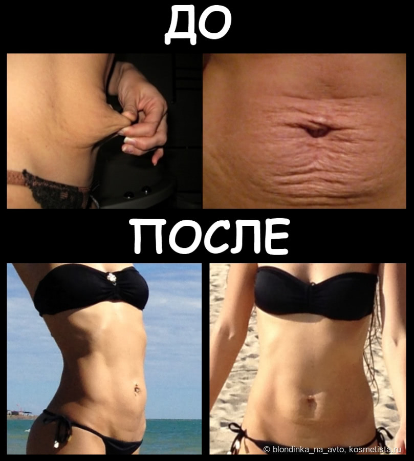 МОЖЕВАЕТСЯ ВОЗОНА 